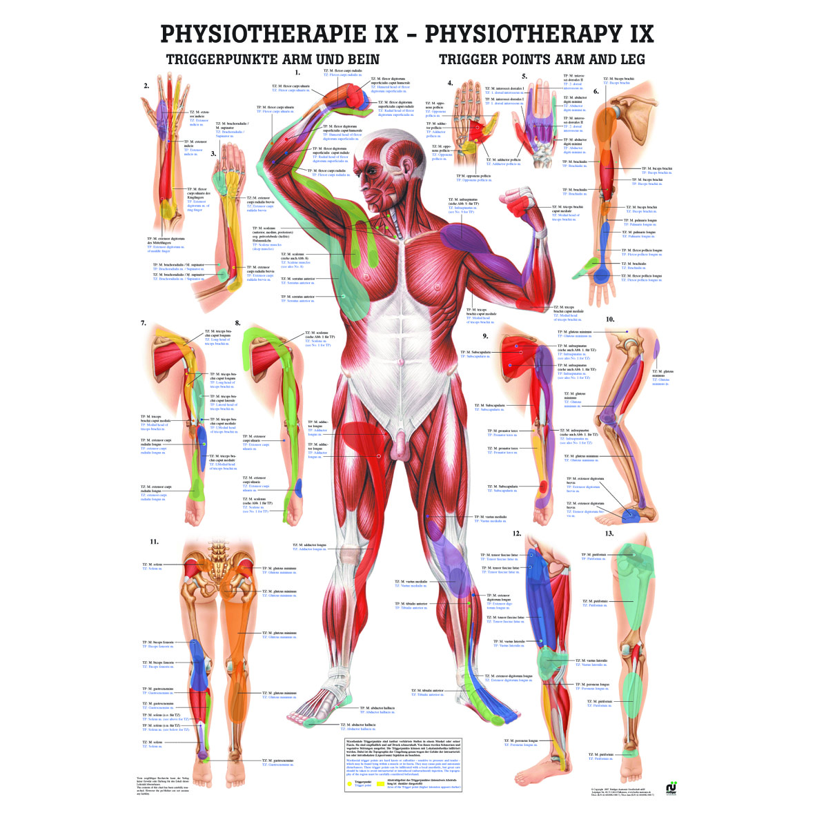 Anatomische Lehrtafel \"Triggerpunkte - Arm und Bein 34 x 24\"